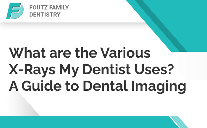 What are the Various X-Rays My Dentist Uses? A Guide to Dental Imaging