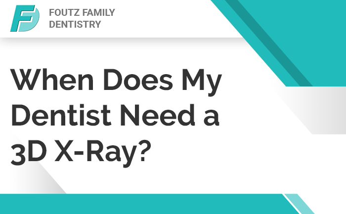 When Does My Dentist Need a 3D X-Ray?