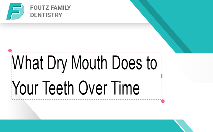 What Dry Mouth Does to Your Teeth