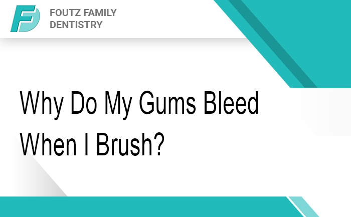 Why Do My Gums Bleed When I Brush?